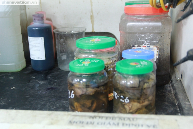 Giấu gia đình làm bác sĩ pháp y: Hành trình tìm sự thật từ những dấu vết lặng im- Ảnh 6.