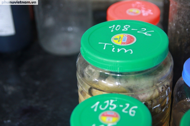 Giấu gia đình làm bác sĩ pháp y: Hành trình tìm sự thật từ những dấu vết lặng im- Ảnh 8.