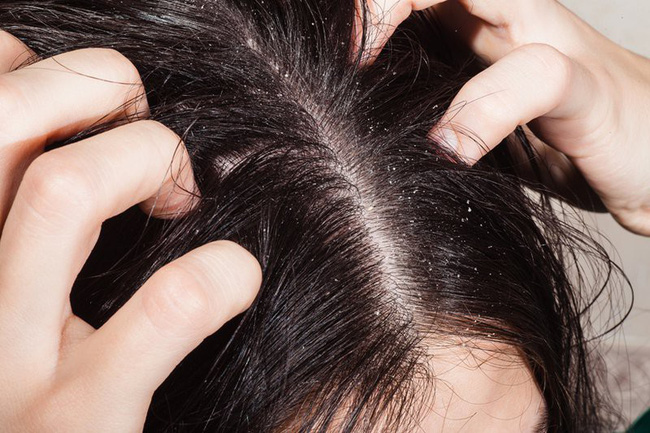 Chủ salon tóc người Hàn chỉ ra sai lầm hủy hoại tóc khi gội đầu: Gái Hàn không bao giờ mắc phải vì hại tóc cực kỳ - Ảnh 3.