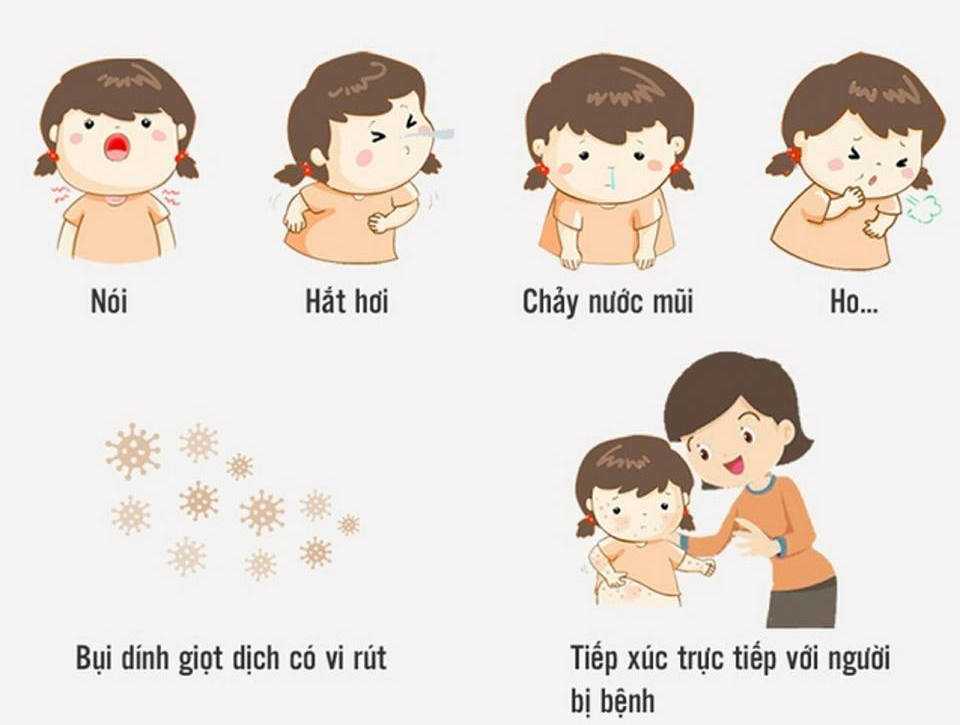 Hiểu về con đường lây nhiễm và cách phòng tránh để ngăn chặn bệnh sởi lây lan - Ảnh 2.