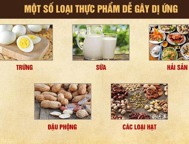 Viêm xoang không nên ăn gì? Những thực phẩm cực hại cho những người bị bệnh viêm xoang - Ảnh 3.