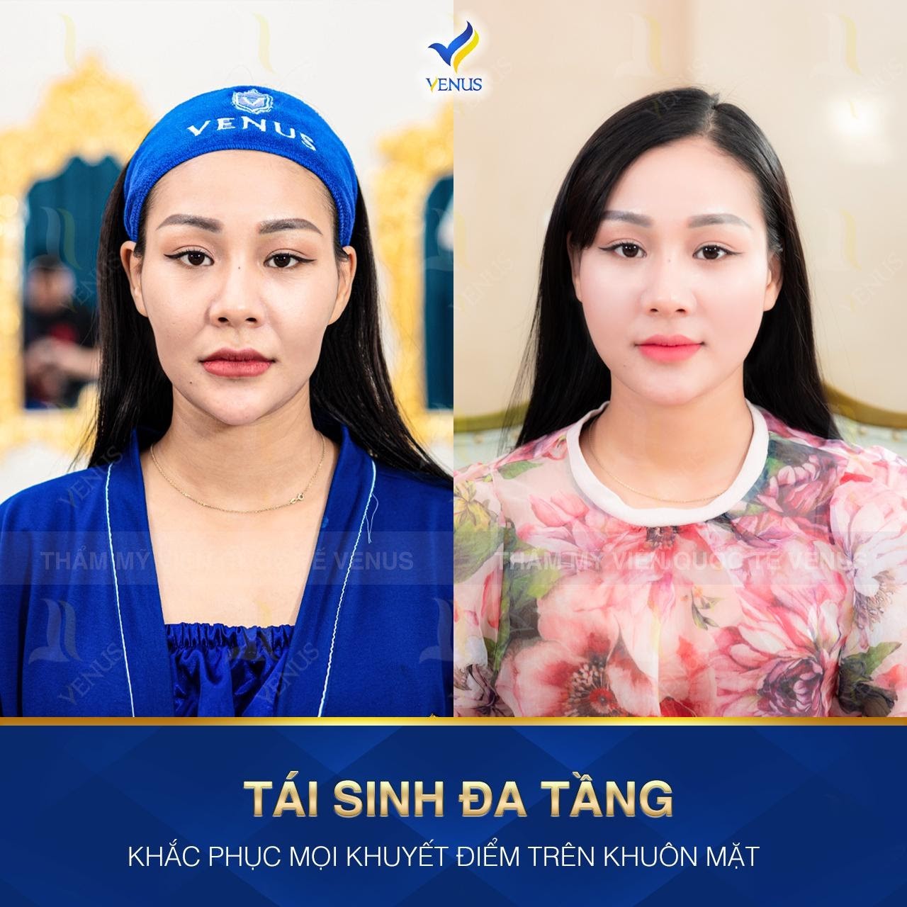 Vén màn bí mật về siêu phẩm tái sinh đa tầng đang làm mưa làm gió trên thị trường làm đẹp - Ảnh 2. Vén màn bí mật về siêu phẩm tái sinh đa tầng đang làm mưa làm gió trên thị trường làm đẹp - Ảnh 2.