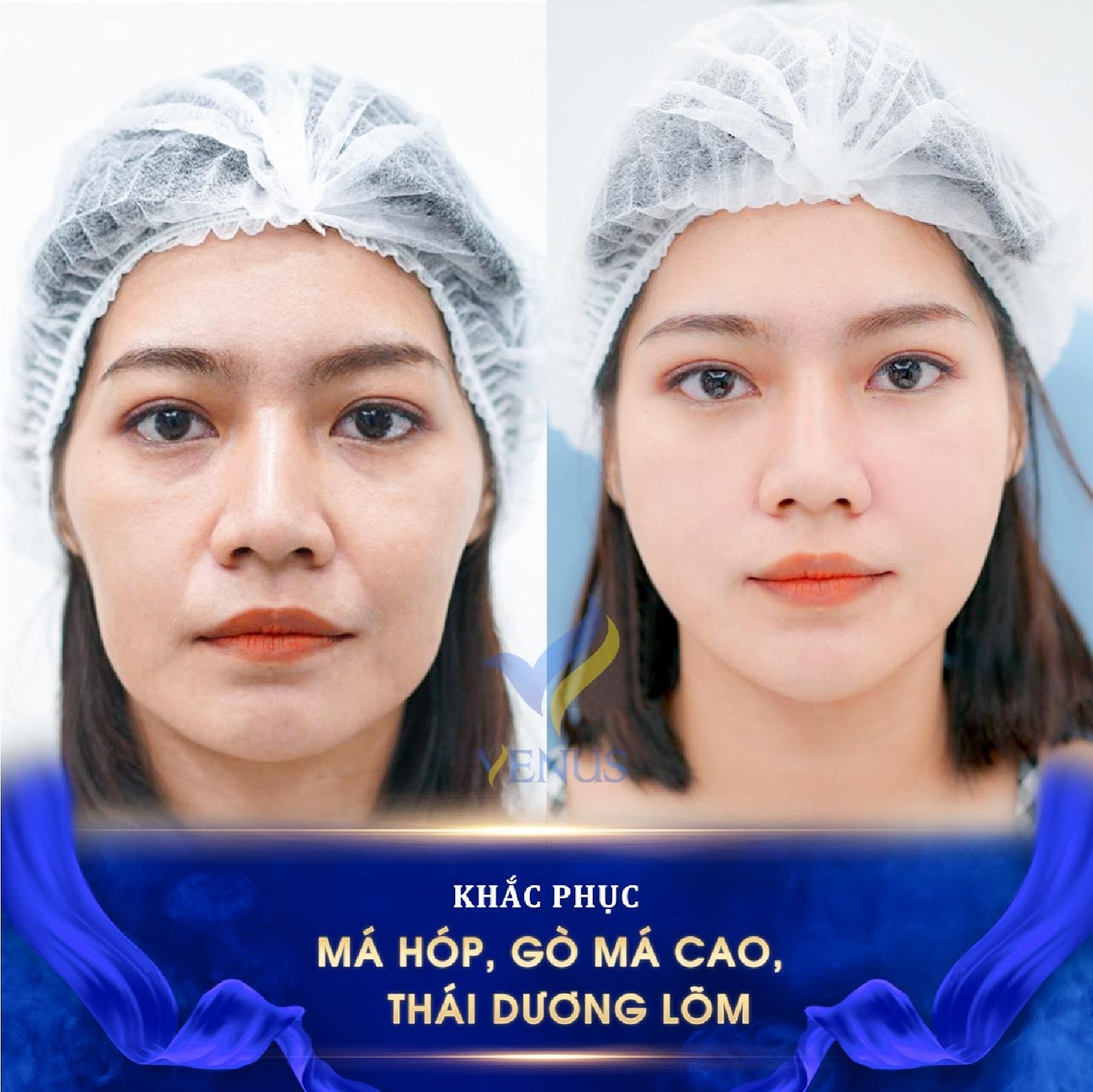 Vén màn bí mật về siêu phẩm tái sinh đa tầng đang làm mưa làm gió trên thị trường làm đẹp - Ảnh 3. Vén màn bí mật về siêu phẩm tái sinh đa tầng đang làm mưa làm gió trên thị trường làm đẹp - Ảnh 3.