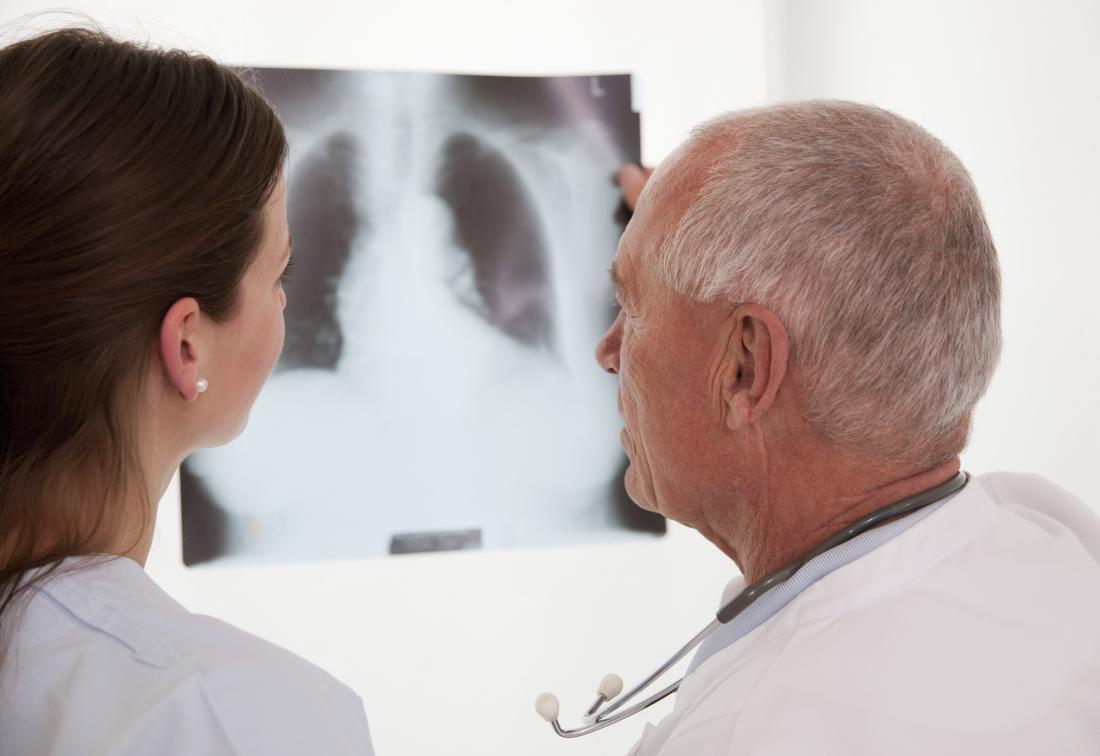 COPD và suy tim: Triệu chứng là gì và chúng liên quan như thế nào? - Ảnh 3.