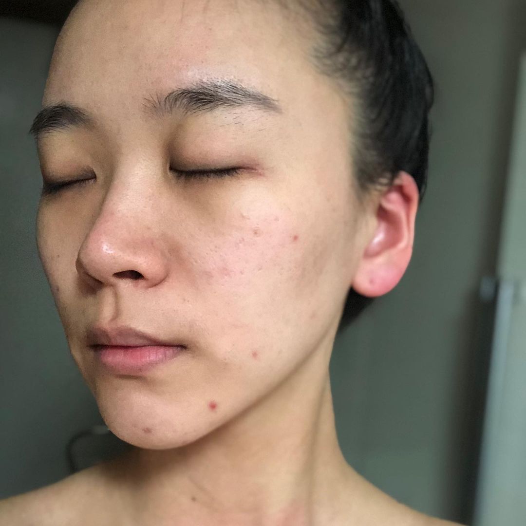 5 dấu hiệu cho thấy bạn đã chọn đồ skincare sai bét, không ngưng dùng ngay thì da càng xấu không lối thoát - Ảnh 5.