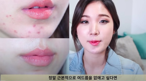 Beauty blogger Hàn chia sẻ nên và không nên ăn gì khi làn da bị mụn - Ảnh 1.