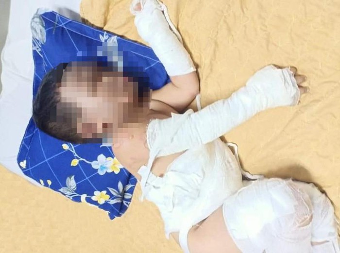 Vụ ném bom xăng ở Bình Dương: Bé trai gặp nạn trong đêm sinh nhật 3 tuổi - Ảnh 1.