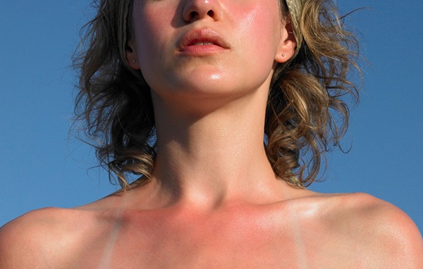 Nan giải đối mặt với loạt bệnh về da ngày hè, nhất là da đổ dầu, bóng nhờn - Ảnh 1.