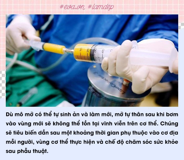 Để không gặp biến chứng, nàng lưu ngay các sai lầm phổ biến thường gặp khi cấy mỡ tự thân - Ảnh 5.