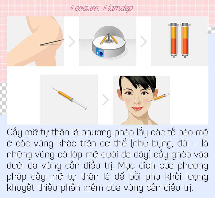 Để không gặp biến chứng, nàng lưu ngay các sai lầm phổ biến thường gặp khi cấy mỡ tự thân - Ảnh 1.