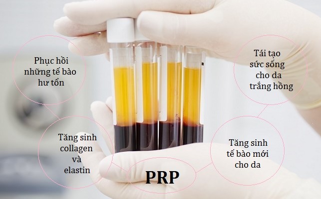 Huyết tương là gì? Thành phần và chức năng của huyết tương - Ảnh 3.