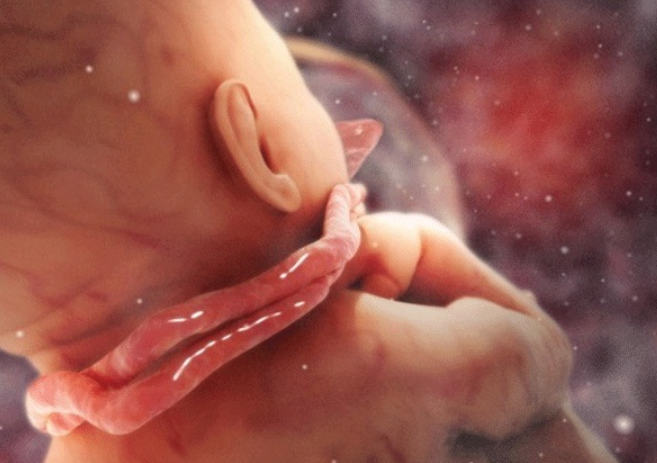Lưu thai là gì? Nguyên nhân và dấu hiệu chết thai lưu - Ảnh 4.