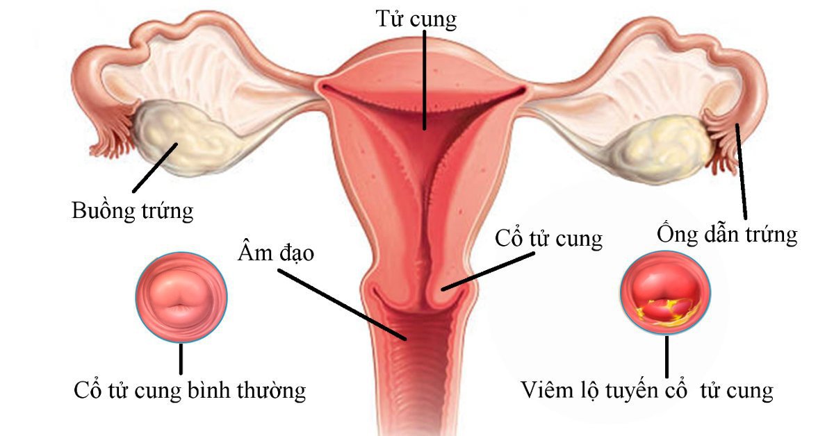 Tử cung ngả trước có dễ thụ thai không? - Ảnh 2.