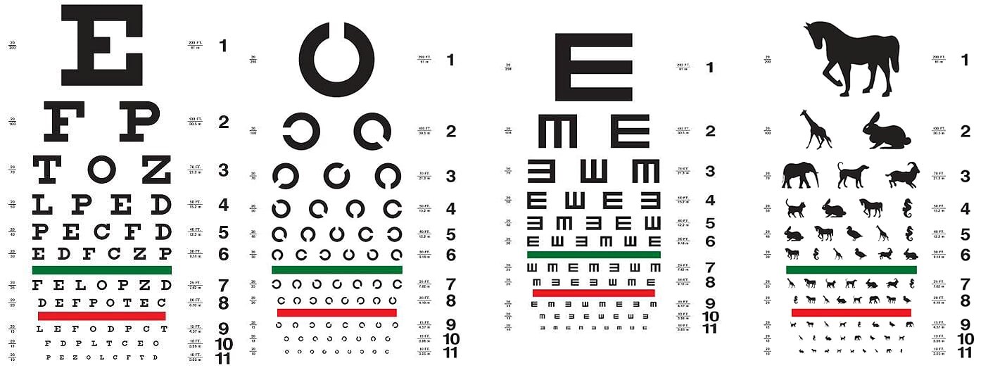 Độ cận là gì? Những điều cần biết về khái niệm độ cận - Ảnh 4.