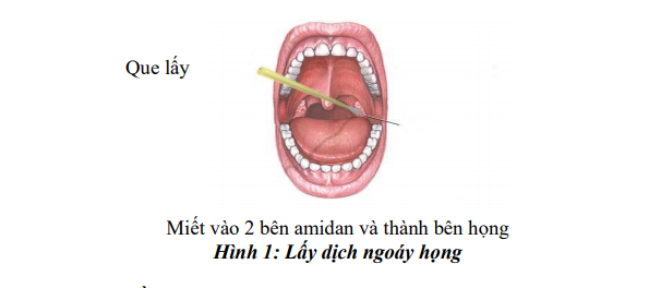 Trung Quốc bắt đầu xét nghiệm nhiễm virus nCoV qua đường “hậu môn”, các chuyên gia nói gì? - Ảnh 2.