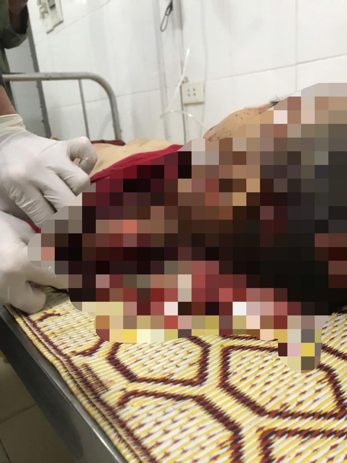Một bé trai 8 tuổi ở Hà Tĩnh tử vong với nhiều vết thương nghi bị chém - Ảnh 1.