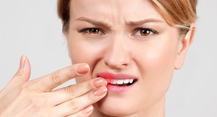 5 dấu hiệu răng bị chết tủy mà bạn cần biết - Ảnh 2.