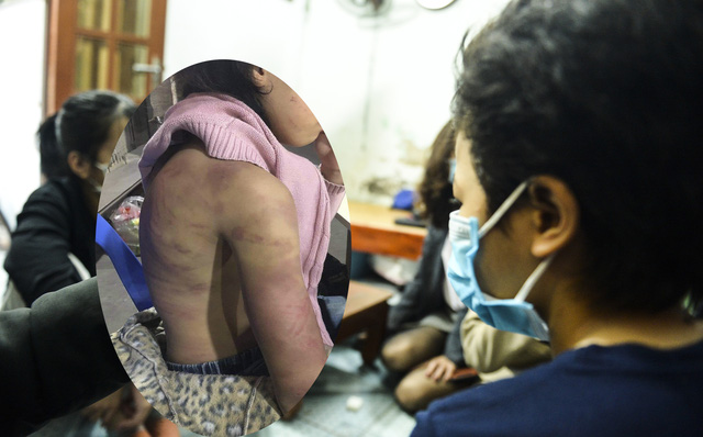 Khởi tố người mẹ và nhân tình bạo hành, xâm hại tình dục bé gái 12 tuổi ở Hà Nội - Ảnh 1.