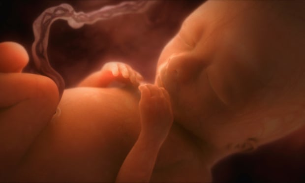 Công nghệ tử cung nhân tạo giúp sinh con mà không phải mang thai - Ảnh 1.