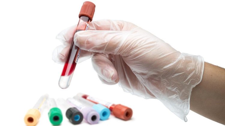 Những điều bạn cần biết về nguyên nhân gây bệnh Rubella - Ảnh 3. Những điều bạn cần biết về nguyên nhân gây bệnh Rubella - Ảnh 3.