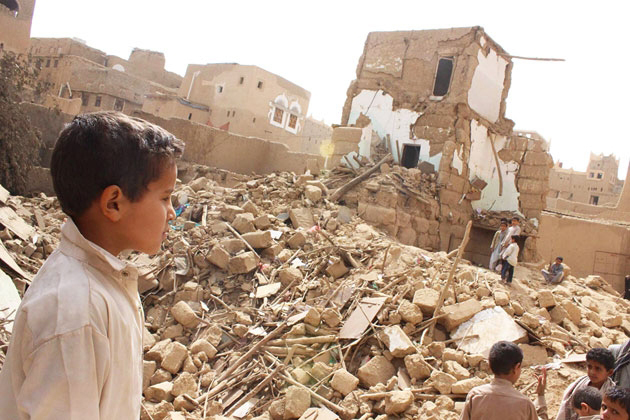 Trẻ em - nạn nhân đau khổ nhất trong chiến sự ở Yemen - Ảnh 1.