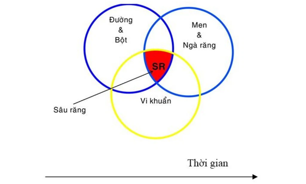 Bé bị sâu răng: Nguyên nhân, điều trị và cách phòng ngừa - Ảnh 1.