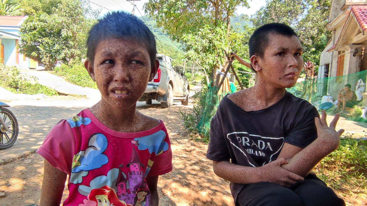 Thắt lòng hình ảnh những đứa trẻ mắc bệnh hiểm nghèo nơi miền sơn cước Phú Thọ