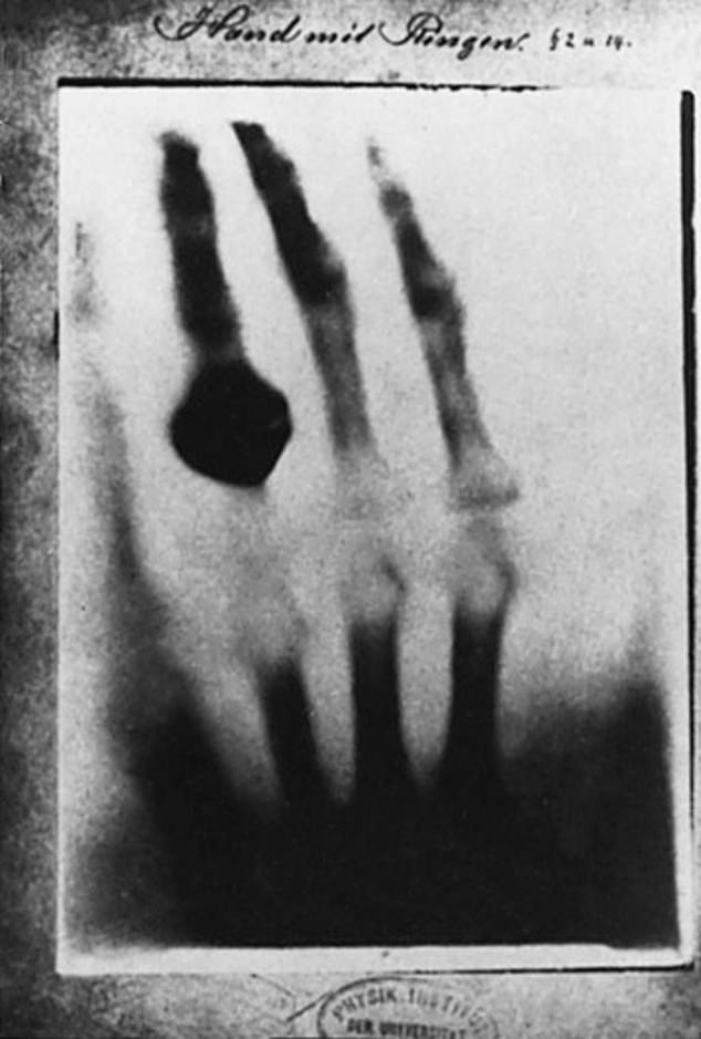 &quot;Vén màn&quot; sự thật đau đớn đằng sau thí nghiệm tạo ra tia X-quang đầu tiên trên thế giới - Ảnh 1.