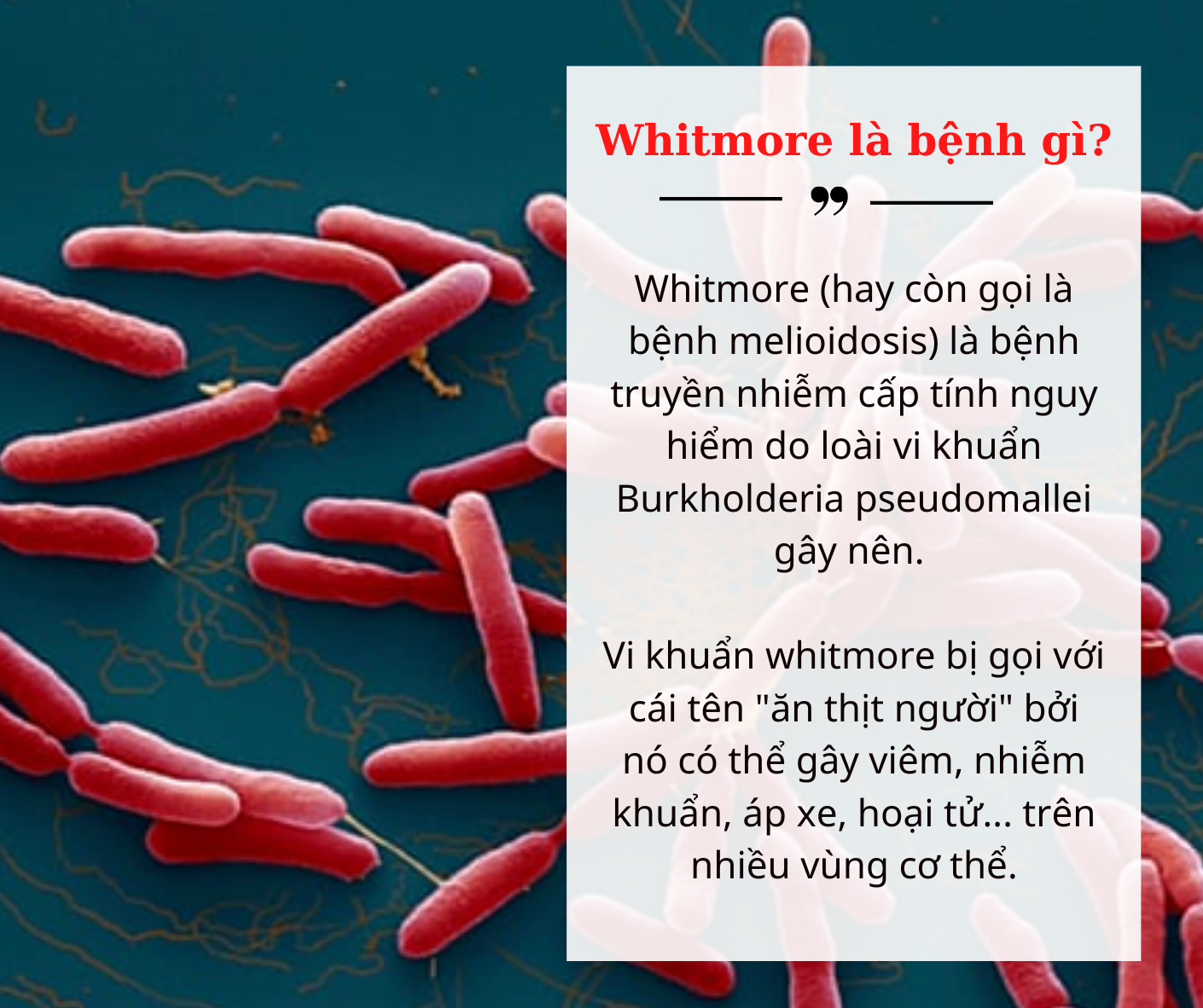 whitmore 16682604717621317620610 1668262522034 16682625228911419986755 - Bệnh nhi 15 tuổi tử vong vì nhiễm vi khuẩn gây bệnh Whitmore: Bệnh nguy hiểm như thế nào?