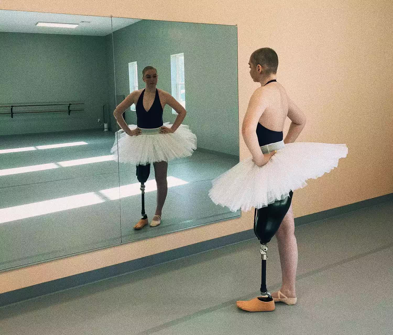 Dù bị ung thư xương và chỉ còn 1 chân, vũ công 21 tuổi vẫn tiếp tục múa ba lê - Ảnh 3.