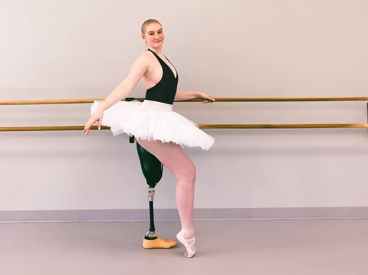 Dù bị ung thư xương và chỉ còn 1 chân, vũ công 21 tuổi vẫn tiếp tục múa ba lê - Ảnh 1.