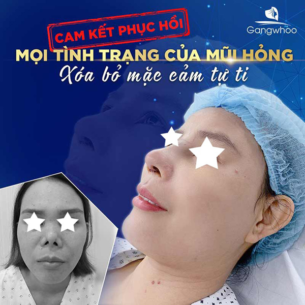 Mừng 8/3, Bệnh viện Thẩm mỹ Gangwhoo tặng 1 triệu đồng kèm quà tặng hấp dẫn - Ảnh 2.