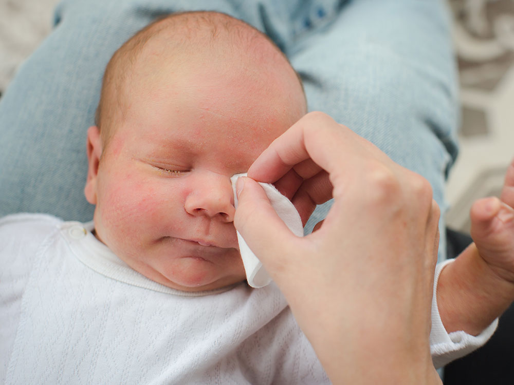 Đừng nghĩ trẻ dụi mắt là buồn ngủ: Nó còn liên quan tới 4 vấn đề nguy hiểm này - Ảnh 3.