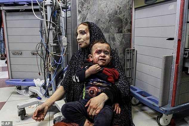 Những bức hình ám ảnh tại bệnh viện Gaza: Ánh mắt hoảng sợ tột cùng của những đứa trẻ vô tội - Ảnh 4.