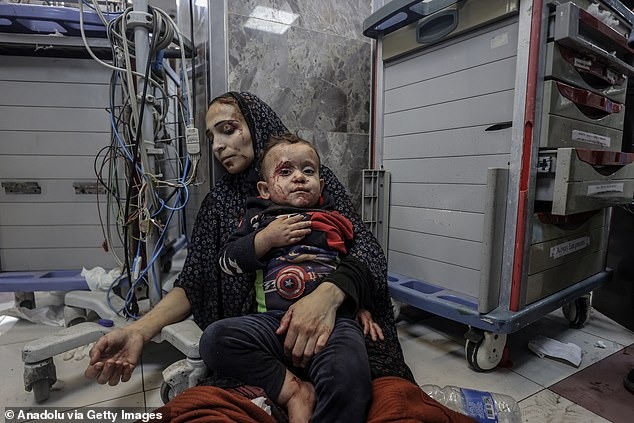 Những bức hình ám ảnh tại bệnh viện Gaza: Ánh mắt hoảng sợ tột cùng của những đứa trẻ vô tội - Ảnh 5.