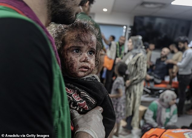 Những bức hình ám ảnh tại bệnh viện Gaza: Ánh mắt hoảng sợ tột cùng của những đứa trẻ vô tội - Ảnh 9.