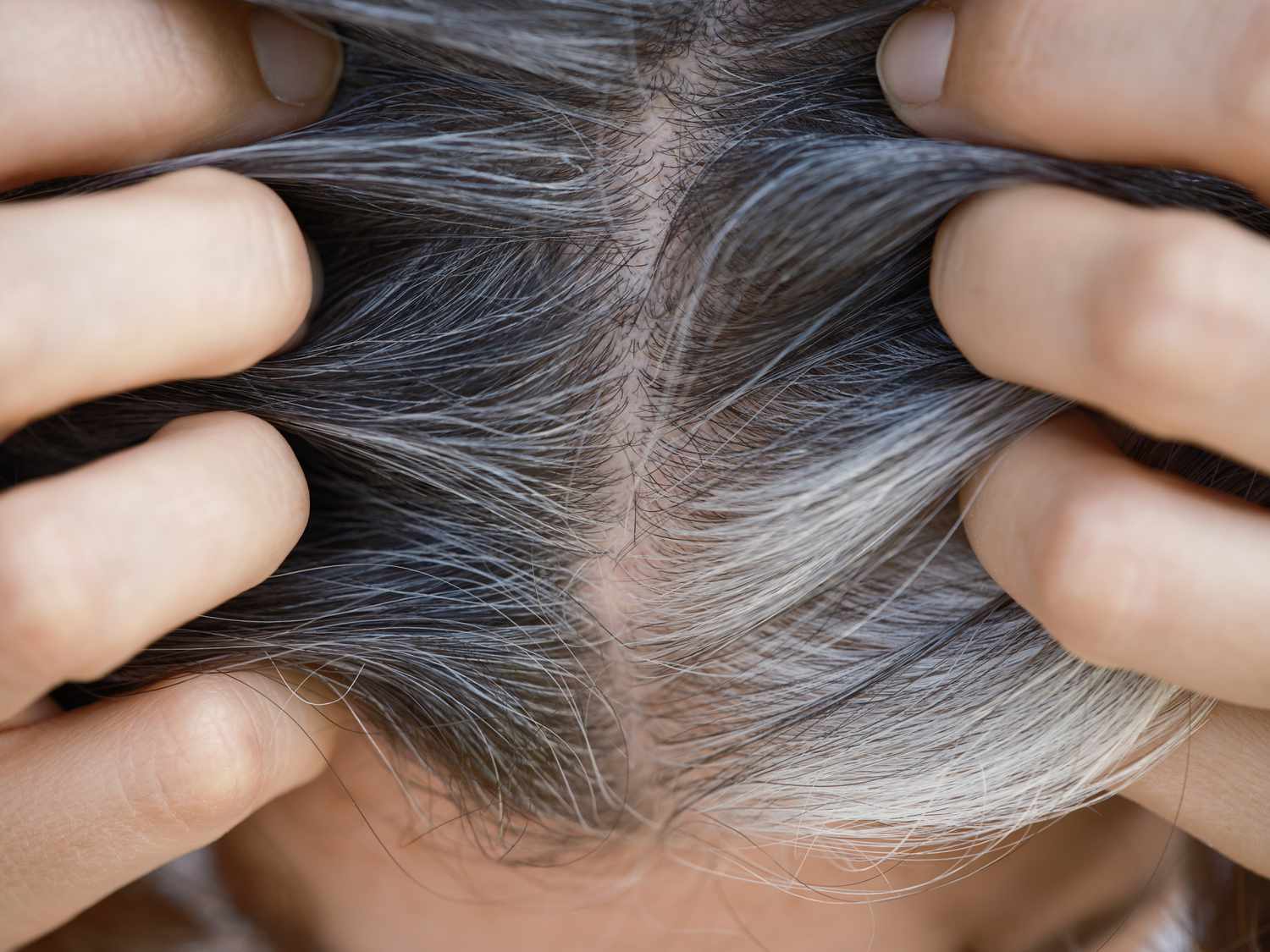 Hiện tượng tóc bạc sớm ở nam giới