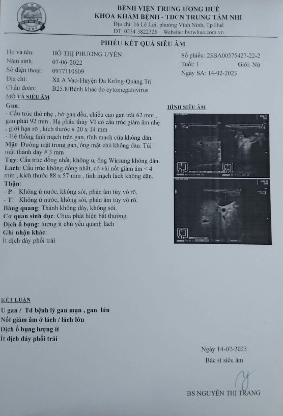 Ánh mắt cầu cứu của bé gái 10 tháng tuổi chỉ nặng 5kg, cái bụng chực nổ tung vì căn bệnh hiểm nghèo - Ảnh 2.