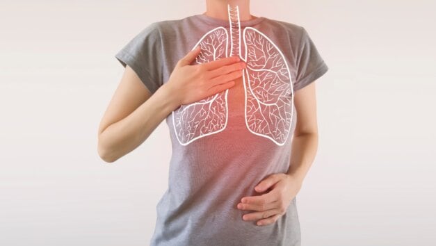 3 triệu chứng nghiêm trọng cảnh báo ung thư phổi: Người trên 40 tuổi càng phải đề phòng - Ảnh 1.