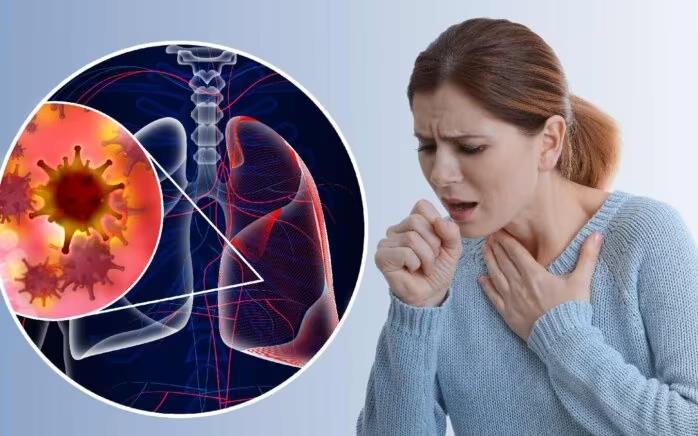 3 triệu chứng nghiêm trọng cảnh báo ung thư phổi