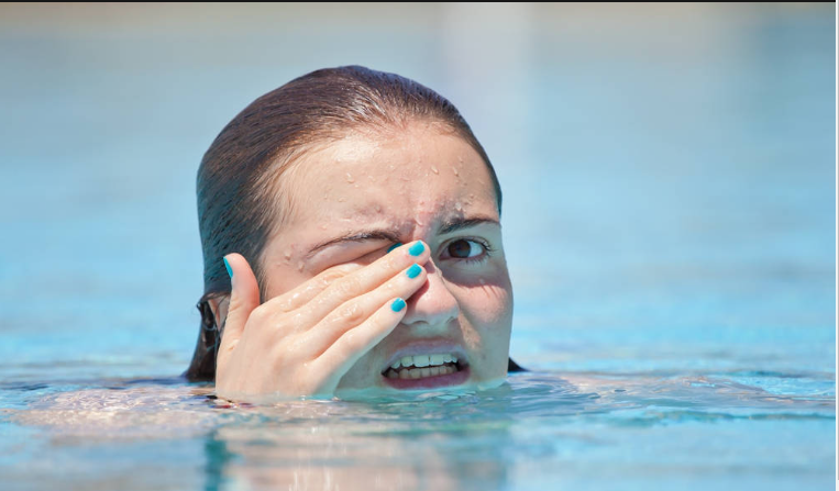 6 mẹo giữ đôi mắt khỏe mạnh khi đi bơi vào mùa hè - Ảnh 3.