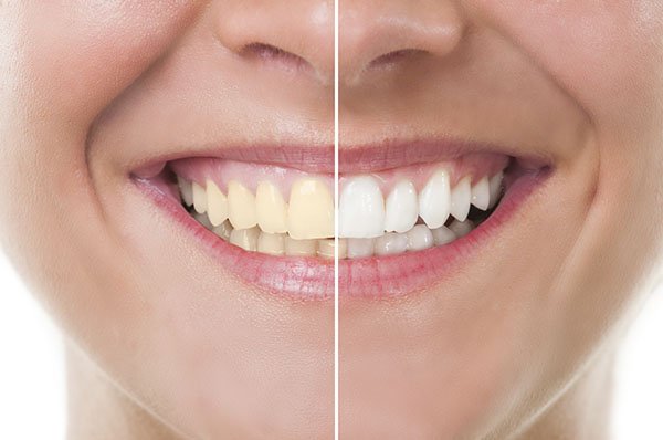 thói quen xấu ảnh hưởng đến men răng