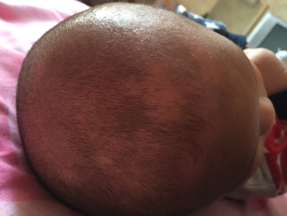 6 trạng thái mọc tóc chứng tỏ trẻ phát triển không bình thường, có thể suy dinh dưỡng - Ảnh 1.