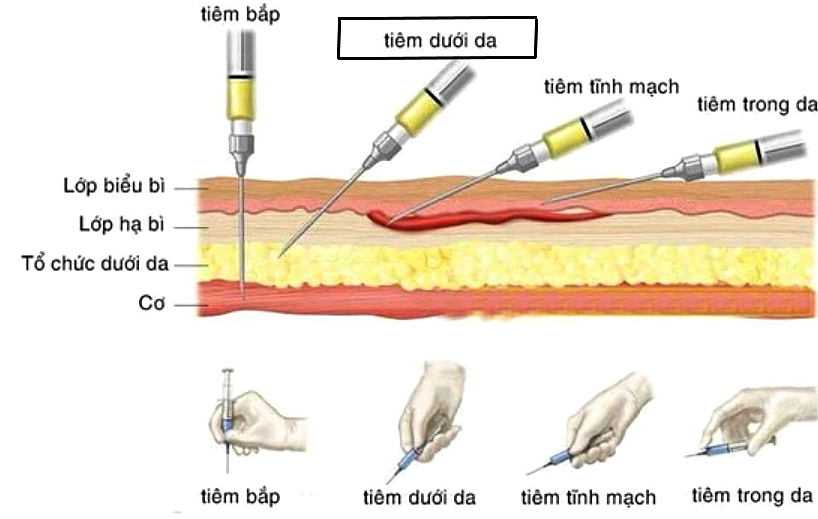 Tiêm meso: Bác sĩ da liễu lý giải vì sao &quot;gây sốt&quot; trong thẩm mỹ nội khoa - Ảnh 1.