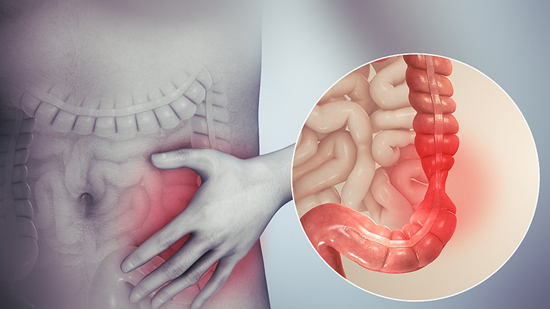 Hoa hậu Hoàn vũ từng bị miệt thị ngoại hình, hóa ra mắc phải căn bệnh có thể gây tăng cân khó kiểm soát - Ảnh 5.