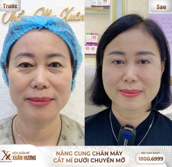 Vu lan báo hiếu, VTM Xuân Hương tri ân công ơn của bậc sinh thành với ưu đãi làm đẹp hấp dẫn - Ảnh 3.