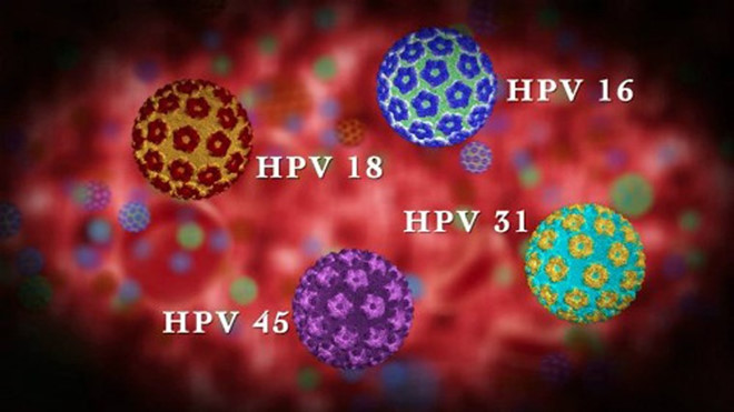 Người đàn ông bất ngờ phát hiện mắc ung thư ở miệng vì chủng virus anh nghĩ chỉ gây bệnh cho phụ nữ- Ảnh 4.