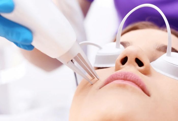 Mụn và mụn thịt: Sự khác biệt và cách điều trị an toàn bạn cần biết- Ảnh 4. Mụn và mụn thịt: Sự khác biệt và cách điều trị an toàn bạn cần biết- Ảnh 4.