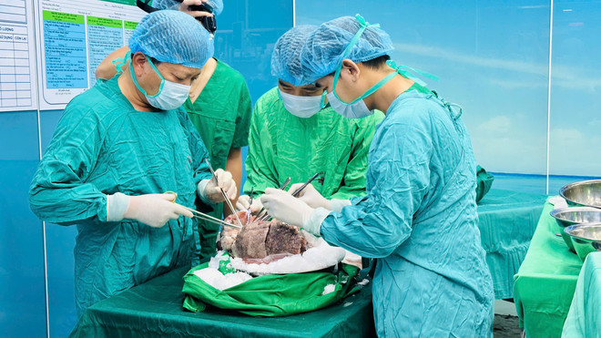 Việt Nam vào danh sách của những Trung tâm Ghép phổi lớn trên thế giới- Ảnh 2.