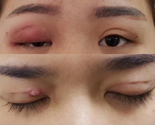 Thẩm Mỹ Mắt Hoa Tâm chia sẻ: Những điều kiện, tiêu chí cần có để làm đẹp an toàn- Ảnh 1. Thẩm Mỹ Mắt Hoa Tâm chia sẻ: Những điều kiện, tiêu chí cần có để làm đẹp an toàn- Ảnh 1.